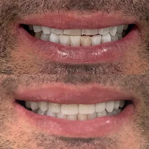 José Américo facetas